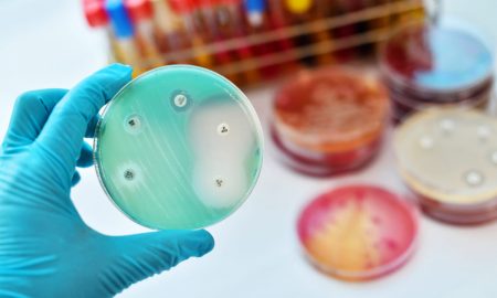 testare rezistenta bacteriana