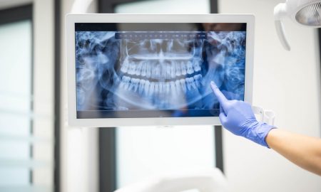 dentist stomatolog radiografie dentara